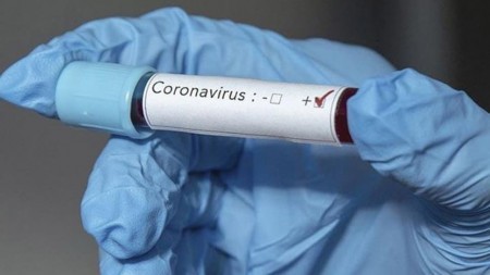Число заболевших коронавирусом в КБР превысило четыре тысячи человек
