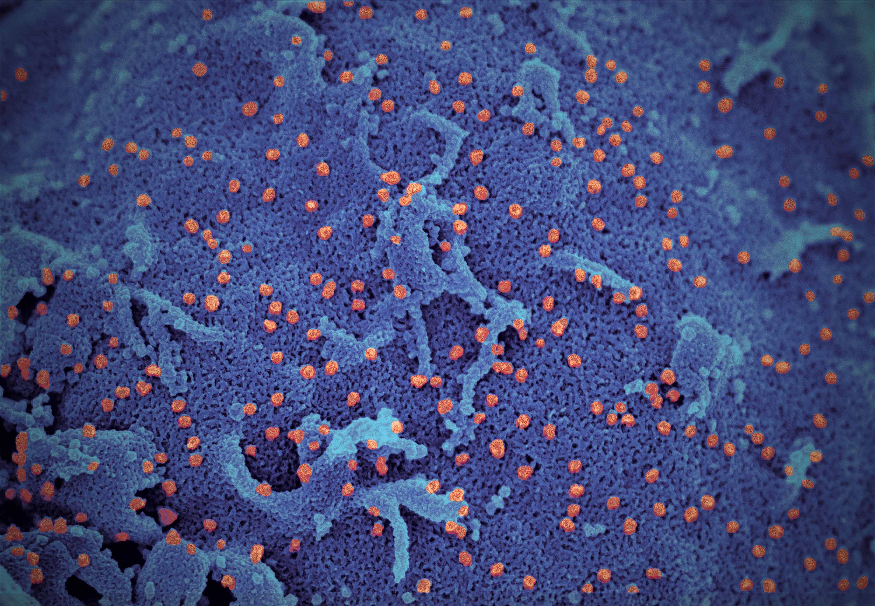 Цвет ковид. Вирус SARS-cov-2 под микроскопом. Коронавирус 2019 под микроскопом. Коронавирус SARS cov 2 под микроскопом. Covid-19 под микроскопом.