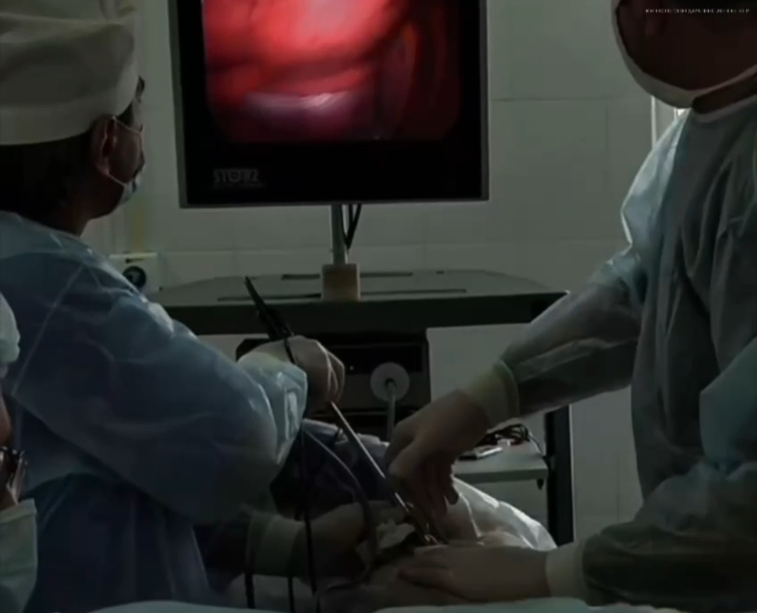 Хирурги противотуберкулезного диспансера вернули дыхательную функцию тяжелому пациенту 